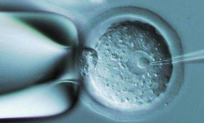 试管婴儿双胞胎性别选择_怎样借卵做试管婴儿_生二胎能在遵化公立医院直接做