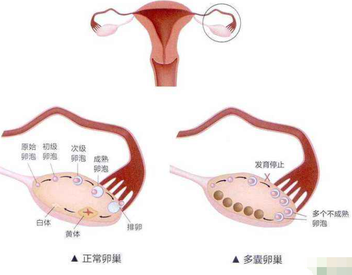 供卵试管需要多长时间_45岁美国试管婴儿医院_二亿分之一：徐州“锦鲤妈妈”